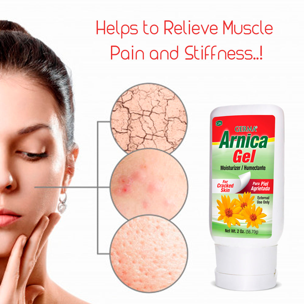 Germa Arnica Gel / Gel de Arnica 2 Oz - SotoDeals
