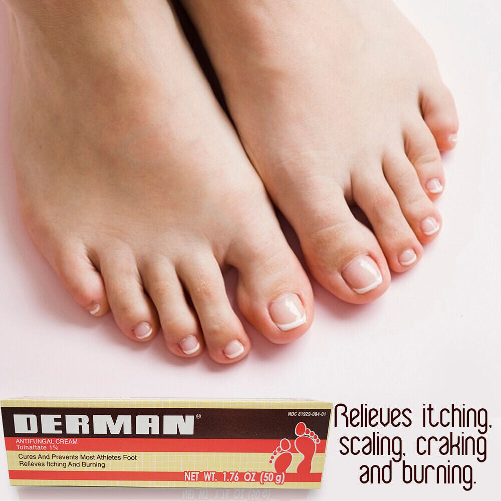 Derman Antifungal Cream Treatment of Athlete's Foot 1.76 Oz. - Pack of 3